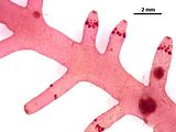 7 - Tetrasporofito con tetrasporocisti